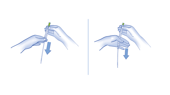 LoFric Origo Pro IFU/Quick guide illustration showing step 5b OPTIONAL: Take out the catheter. 